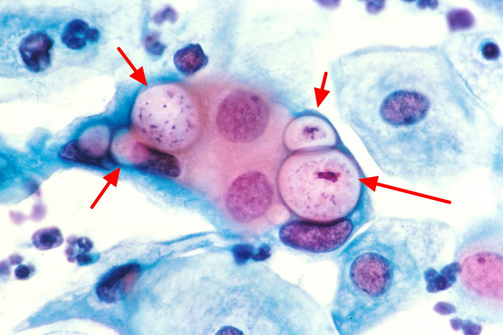 Chlamydia Trachomatis Gram Stain Morphology