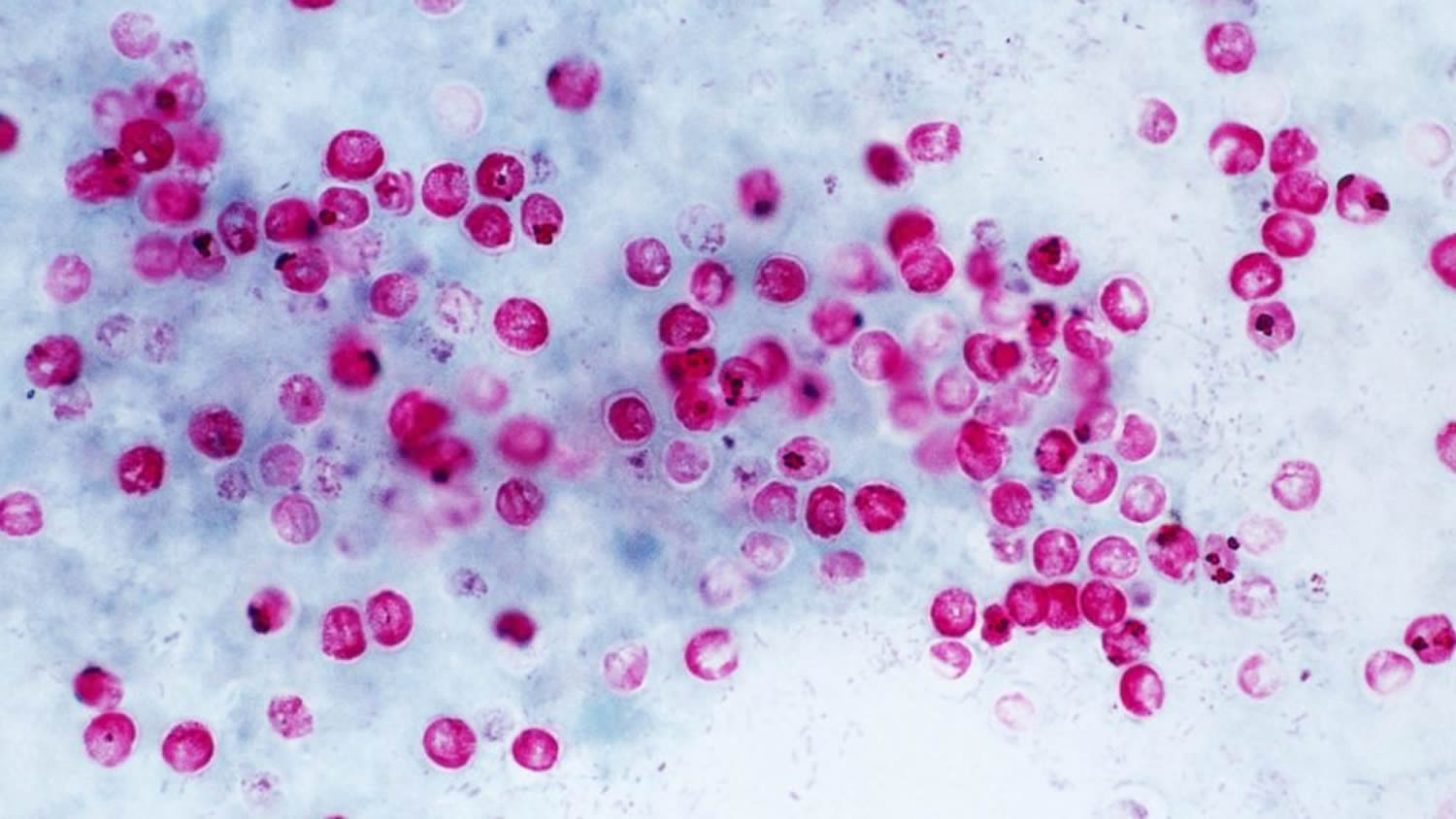 Cryptosporidium Life Cycle Dogs