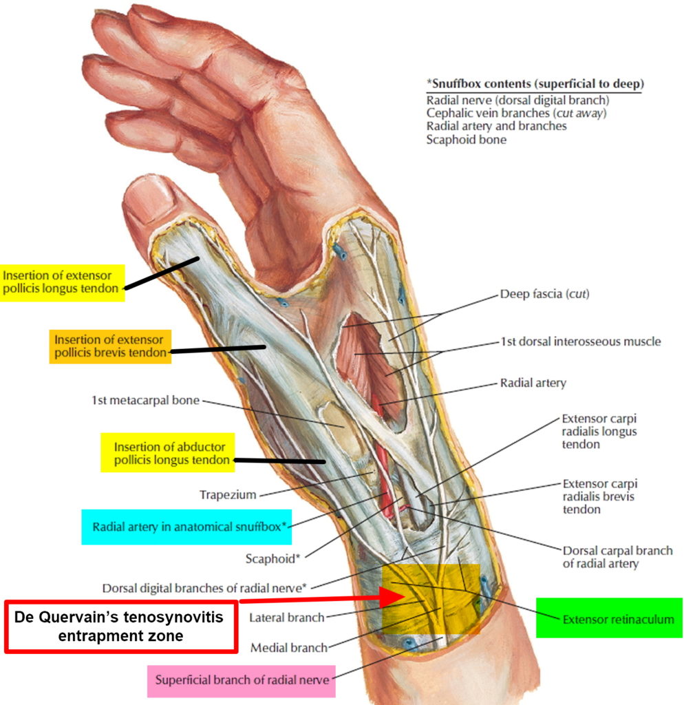 de-quervain-s-tenosynovitis-causes-symptoms-test-exercise-surgery