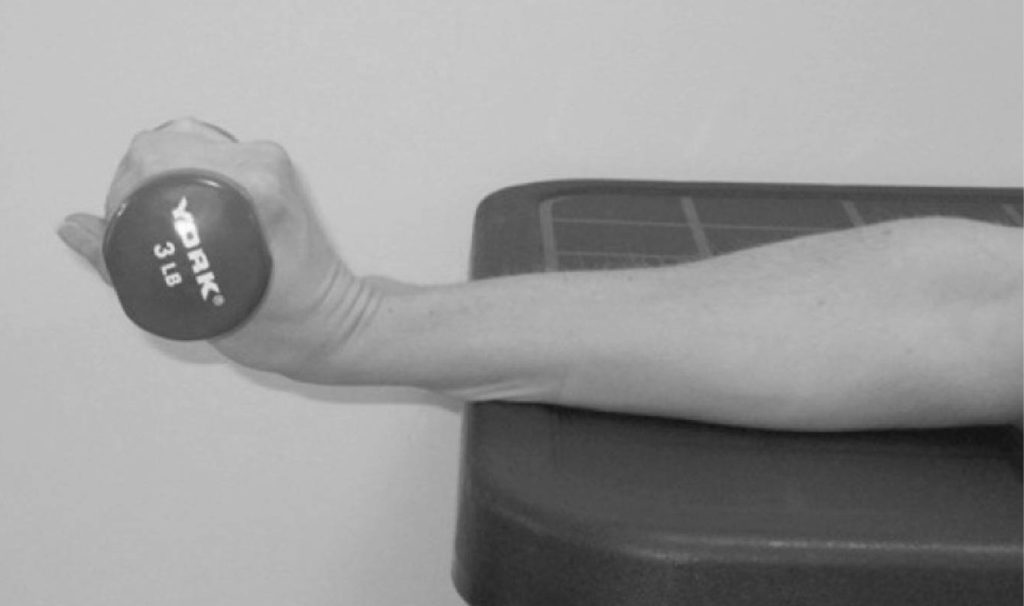 De Quervain syndrome causes, symptoms, diagnosis, treatment, exercises