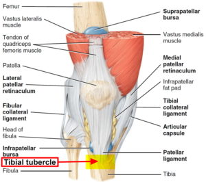 Osgood Schlatter Disease - Causes, Symptoms, Prognosis & Treatment