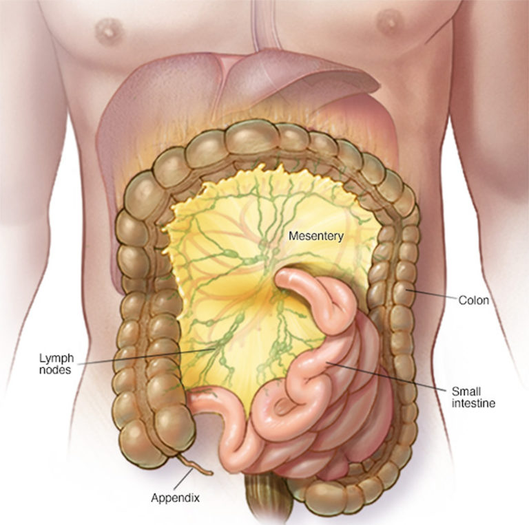 mesenteric-adenitis-causes-symptoms-duration-diagnosis-treatment