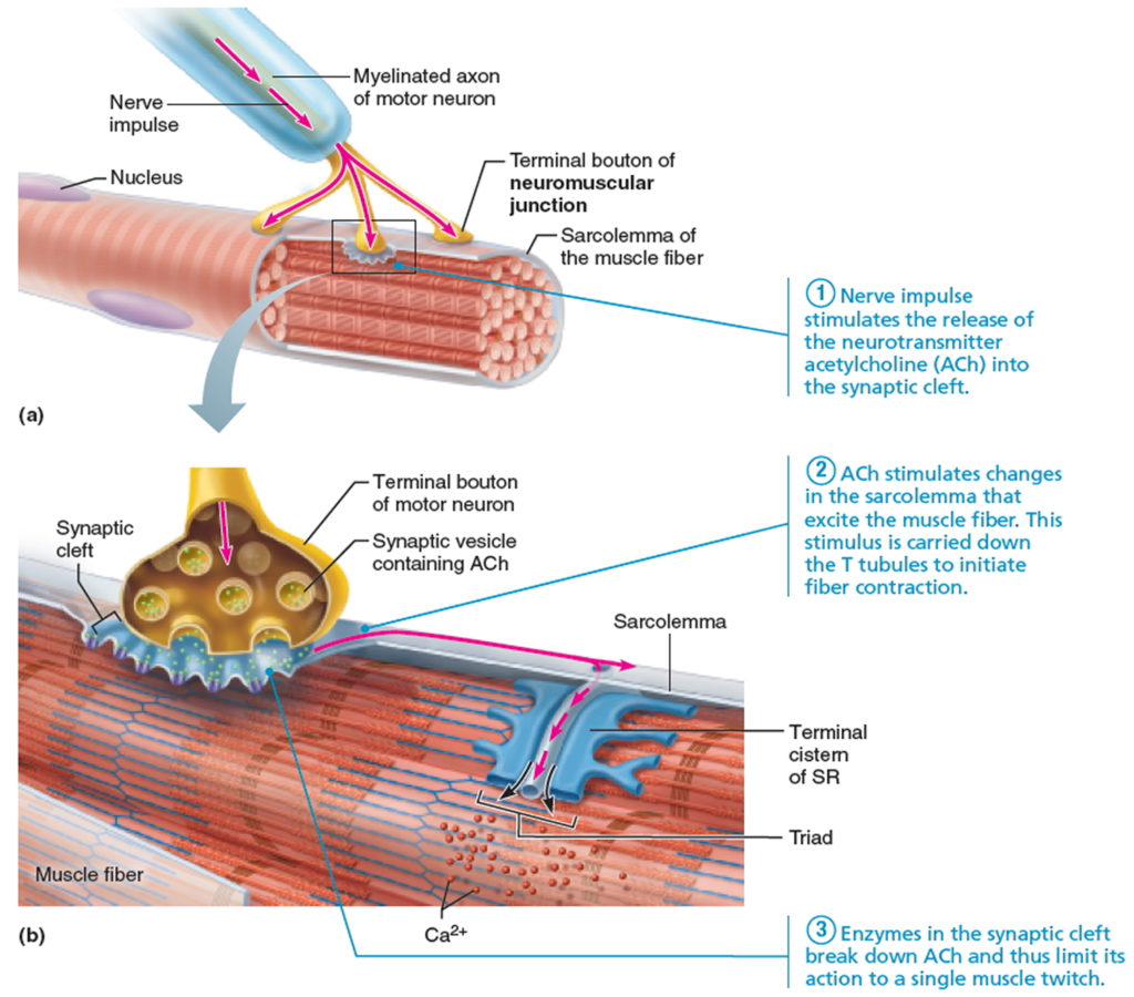 Myasthenia Gravis - Causes, Symptoms, Prognosis, Diagnosis, Treatment