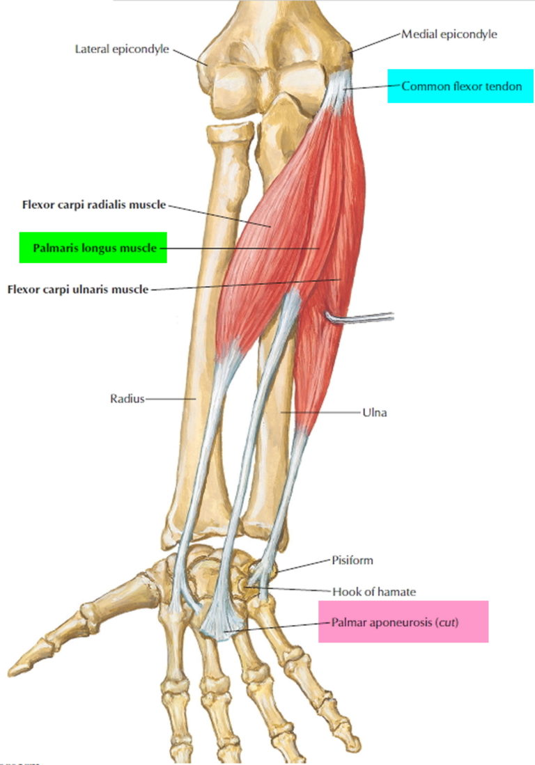 Dupuytren's Contracture - Causes, Symptoms, Treatment