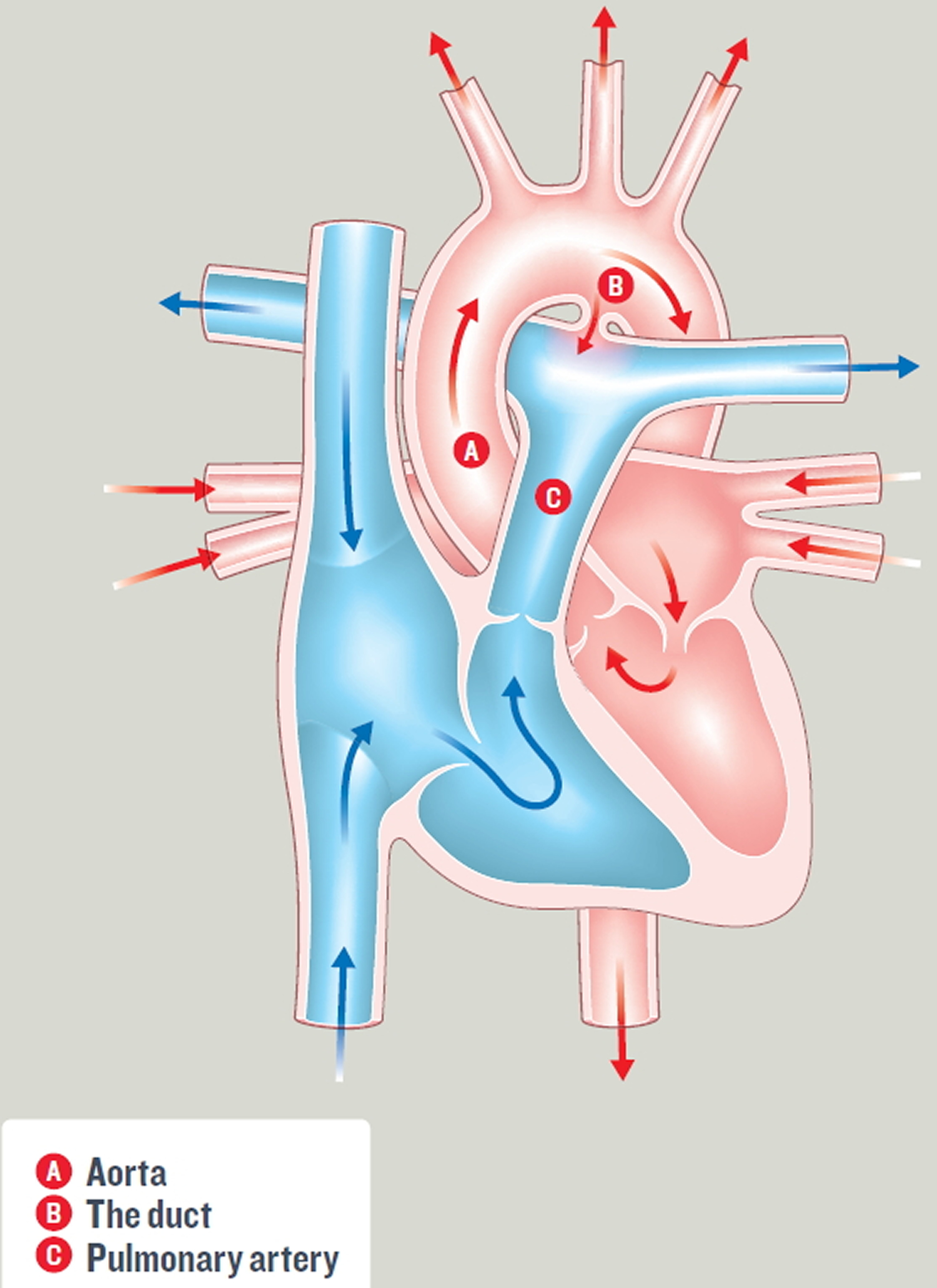 patent-ductus-arteriosus-causes-symptoms-diagnosis-treatment