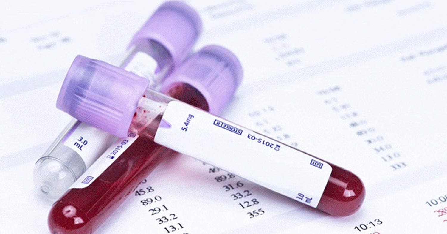 MCV Blood Test Levels Normal MCV What Does It Mean In A Blood Test