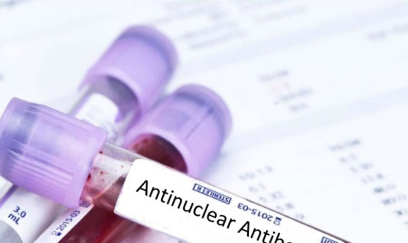 antinuclear antibody