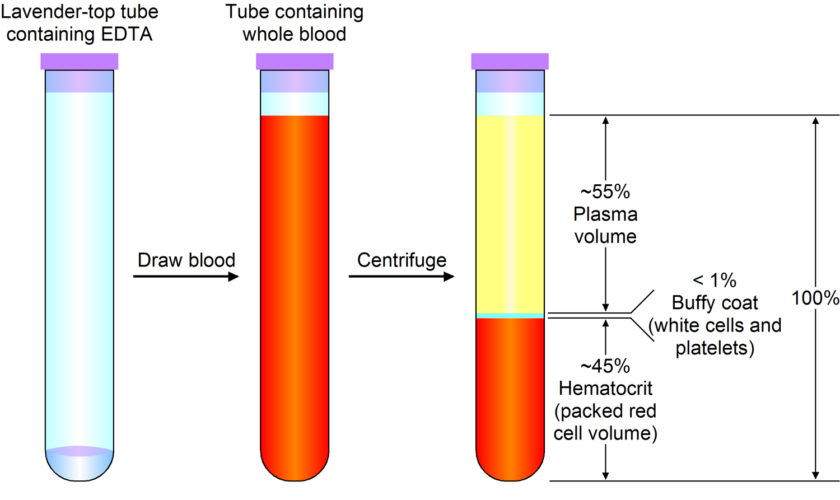 hematocrit-to-hemoglobin-ratio-calculator-example