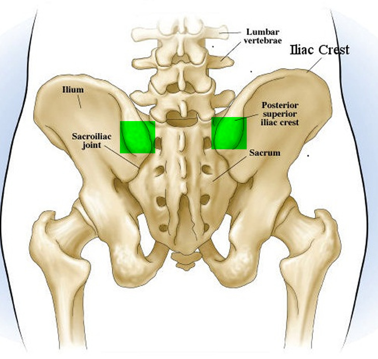 Bone Marrow Biopsy - Reasons, Pain, Complications