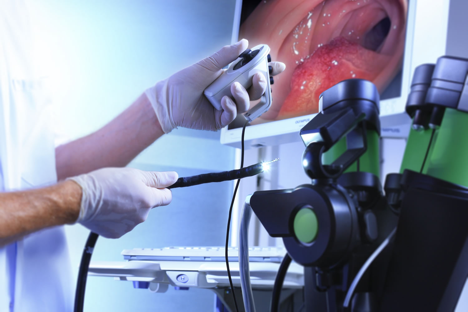 upper-gi-endoscopy-in-exeter-devon-exeter-gut-clinic