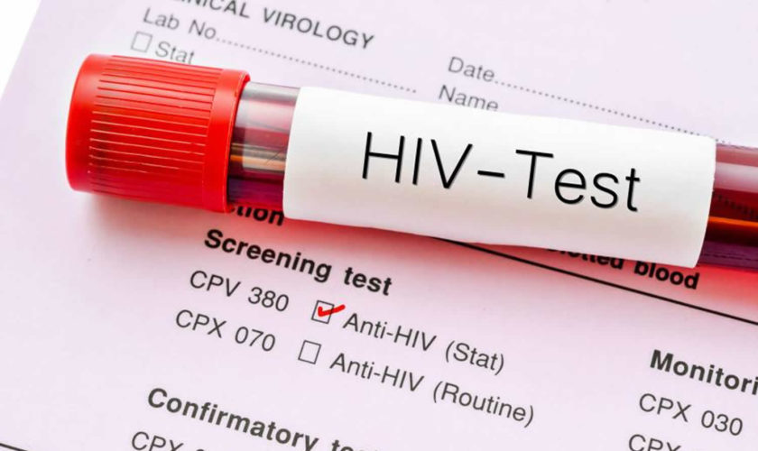 hiv test