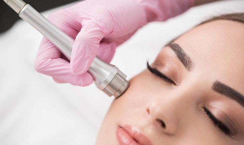 microdermabrasion