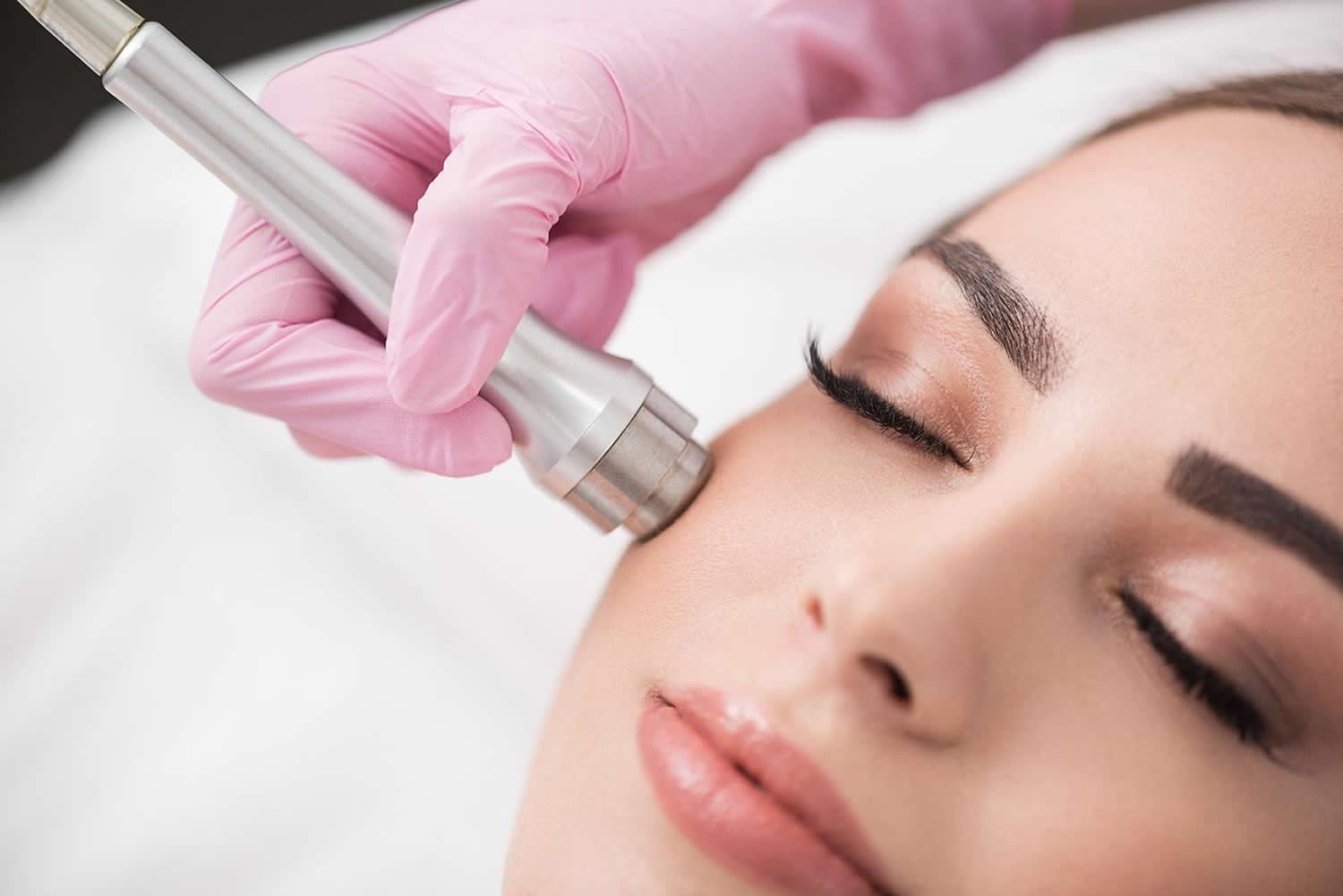 Microdermabrasion Facial Benefits How Often Side Effects