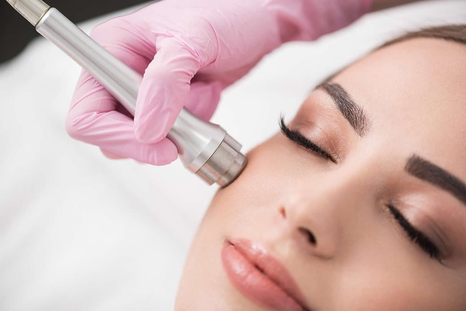 Microdermabrasion Facial, Benefits, How Often, Side Effects