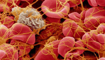 platelet count