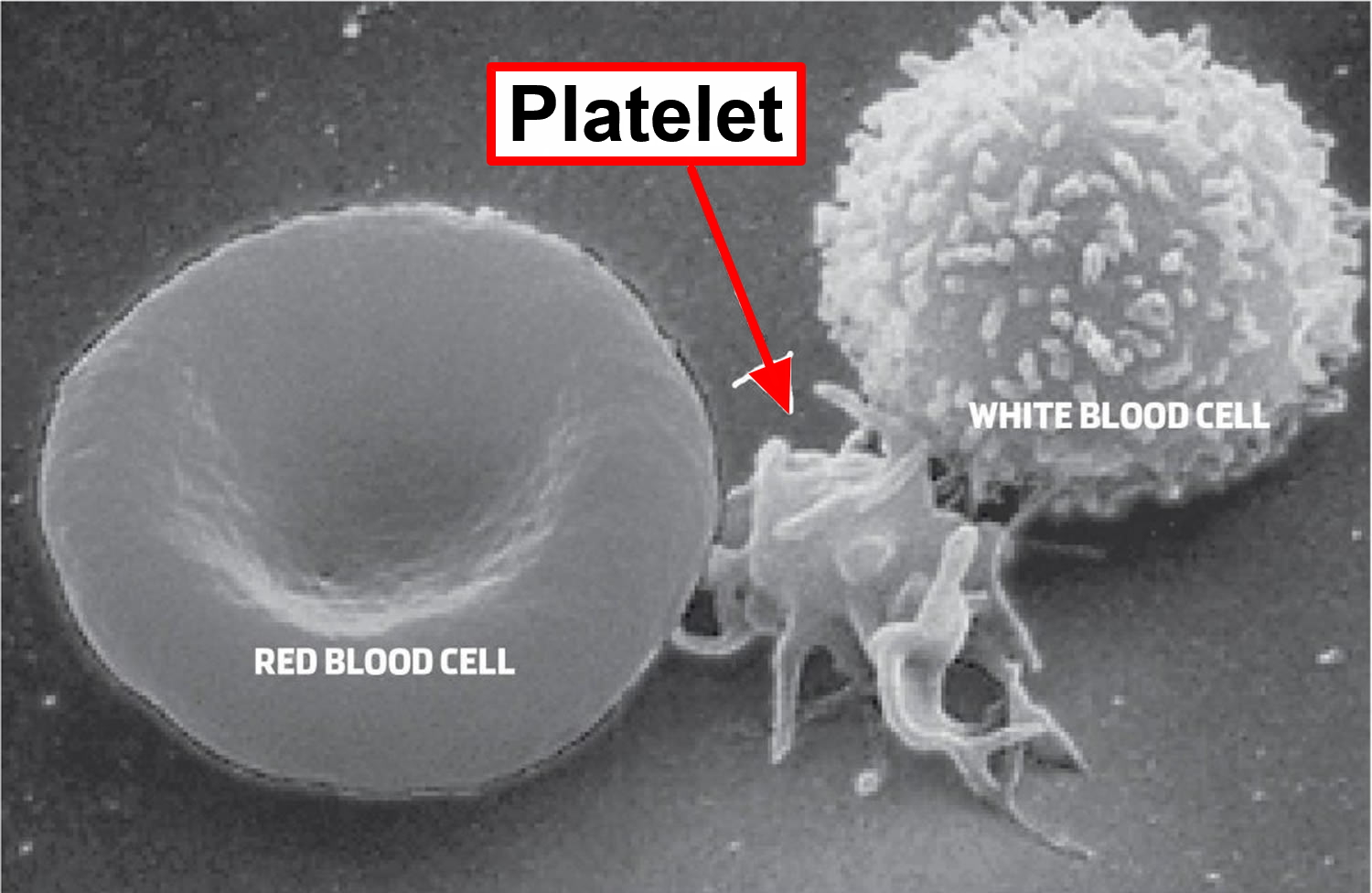 platelet-count-high-low-platelet-count-causes-treatment