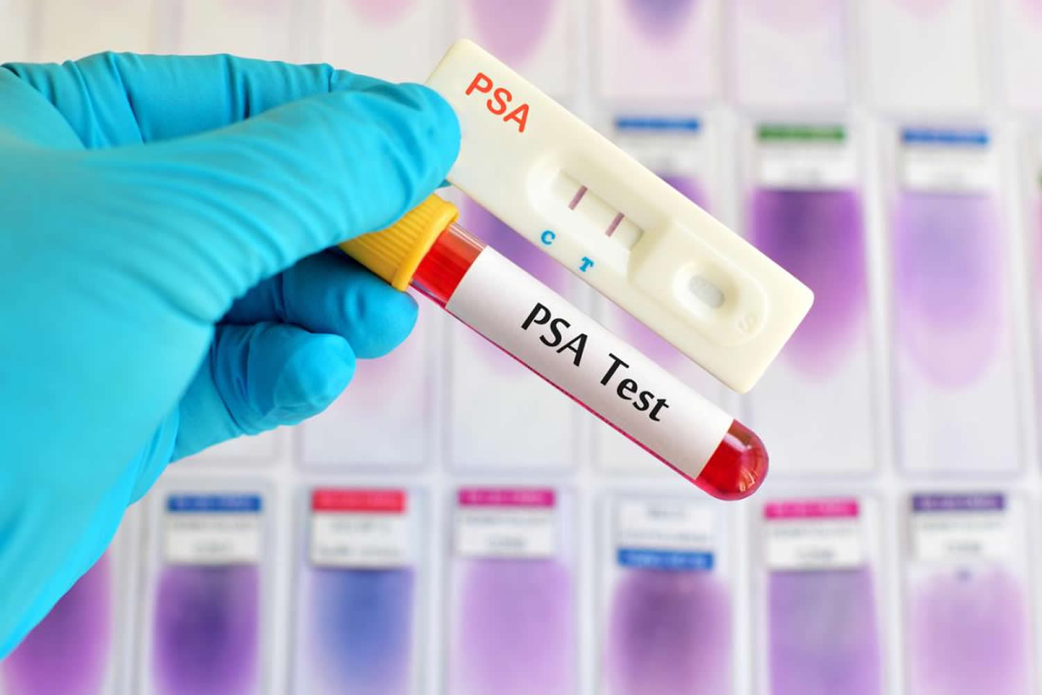 PSA Test Results Elevated Psa Levels Normal Psa Levels By Age