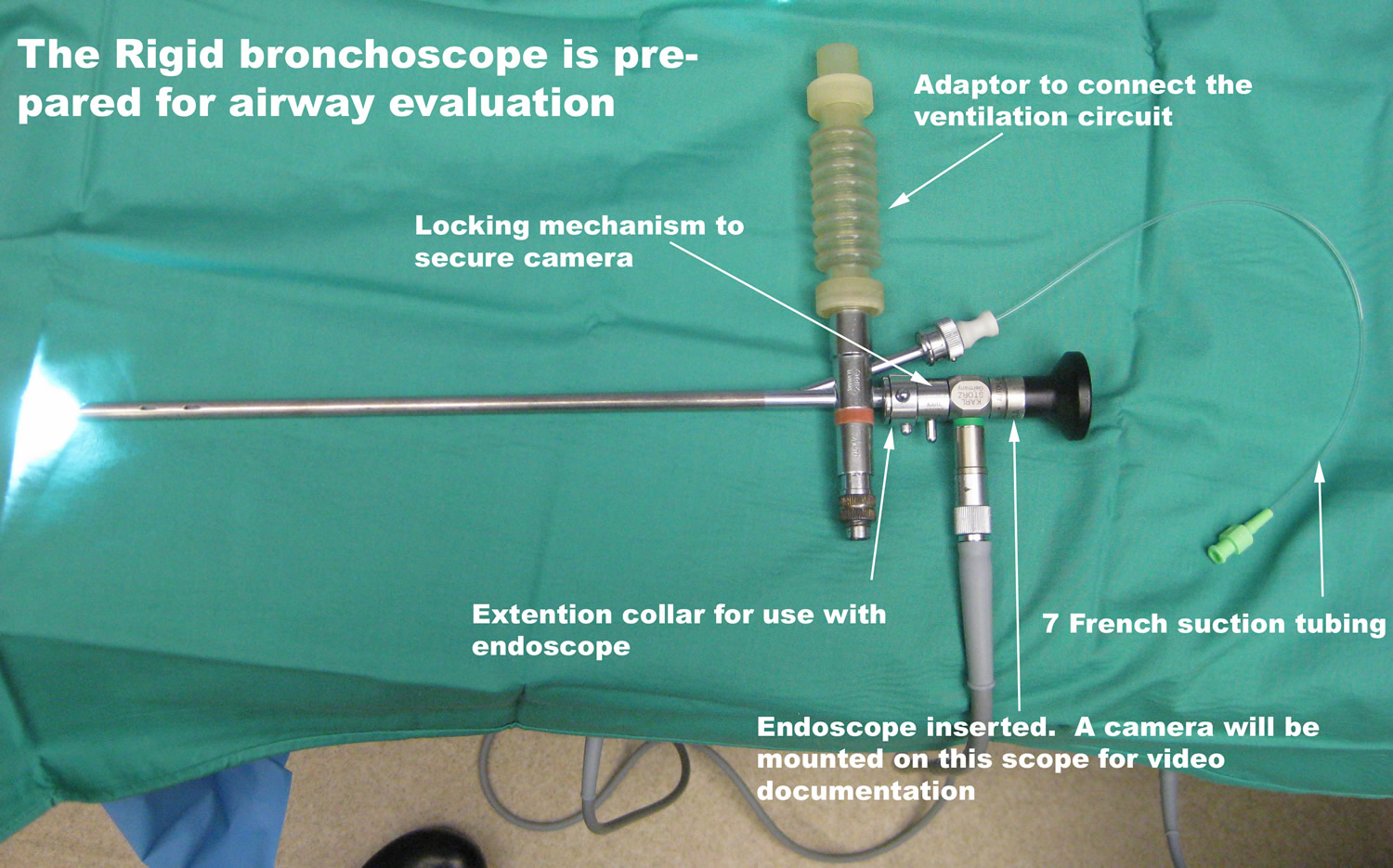 Bronchoscopy Uses, Fiberoptic, Ebus, Rigid, Side Effects