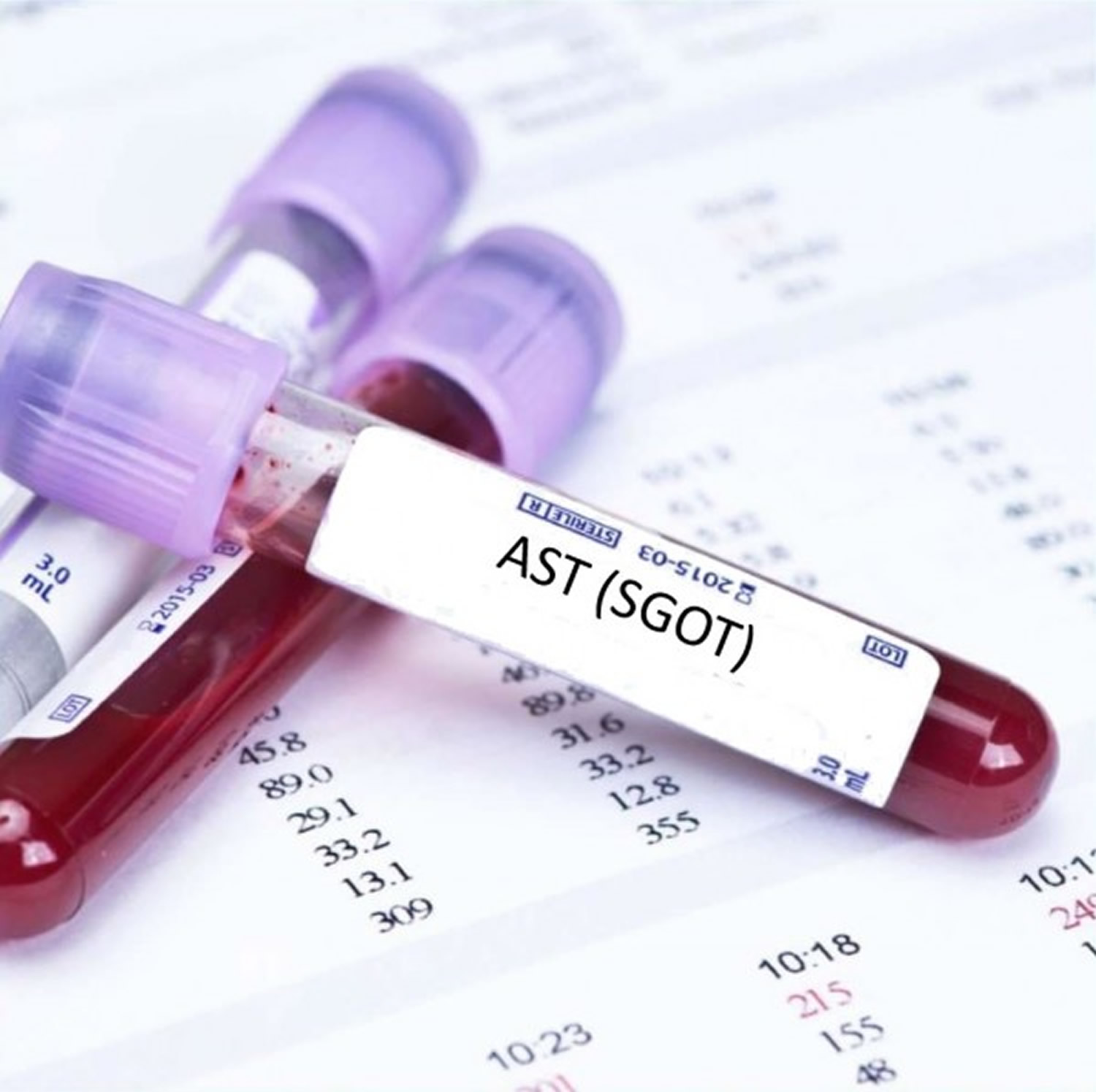 AST SGOT Blood Test Normal Range, Causes of High AST