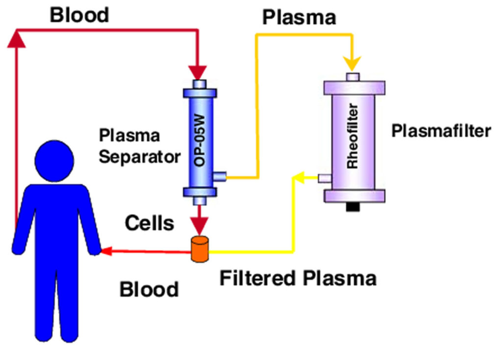 Plasmapheresis - Indications, Plasmapheresis Side Effects