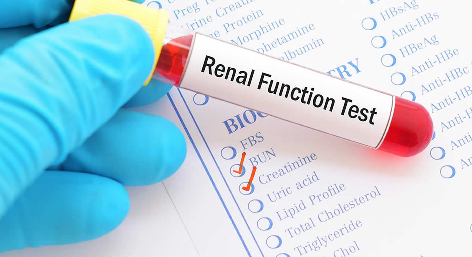 kidney function test research paper