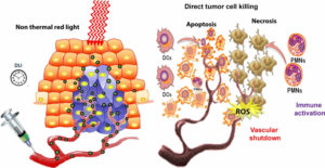 Photodynamic Therapy  Reviews, Uses, Side Effects