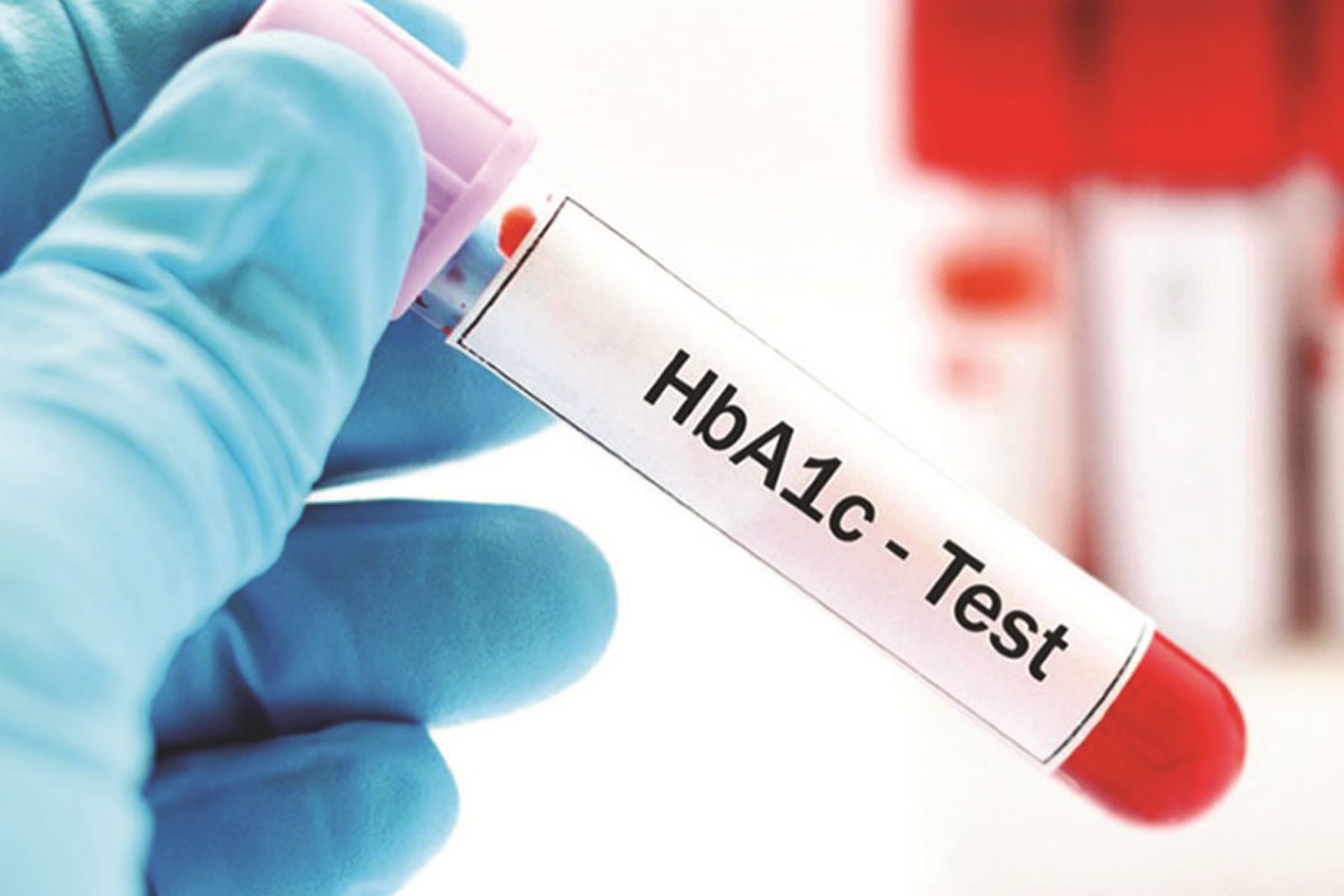 HbA1c -( Ifcc nedir?