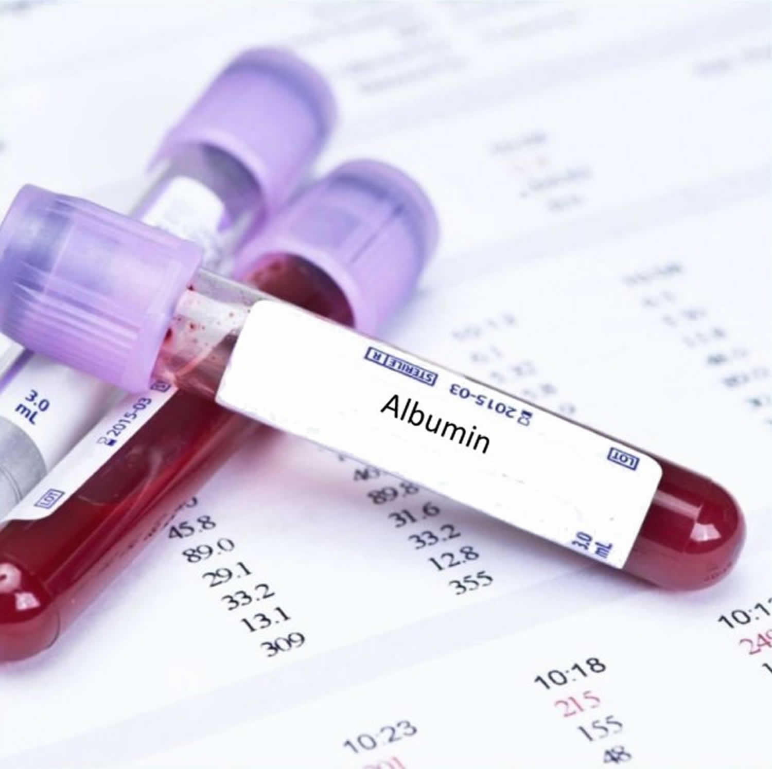 Albumin Function Albumin Levels And Causes Of High Or Low Albumin Levels