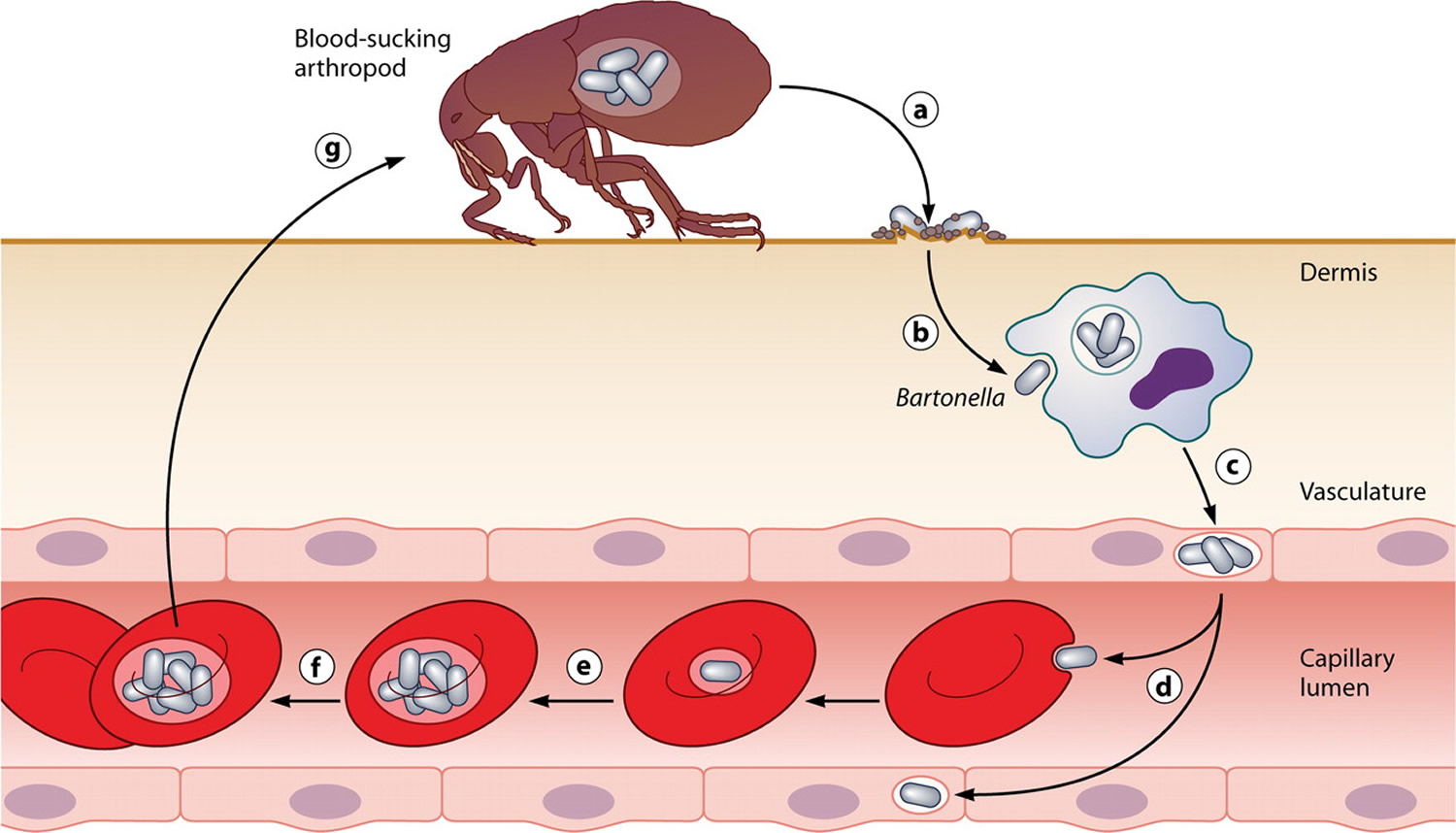 Bartonella Infection Symptoms Diagnosis Test And Bartonella Disease