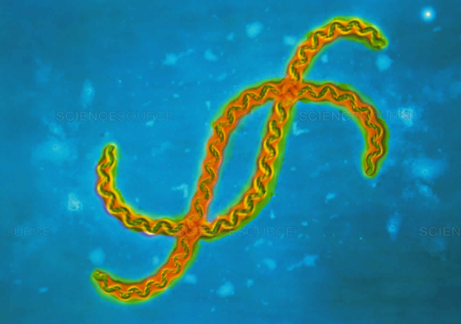 Leptospirosis in humans causes, prevention, symptoms, diagnosis & treatment