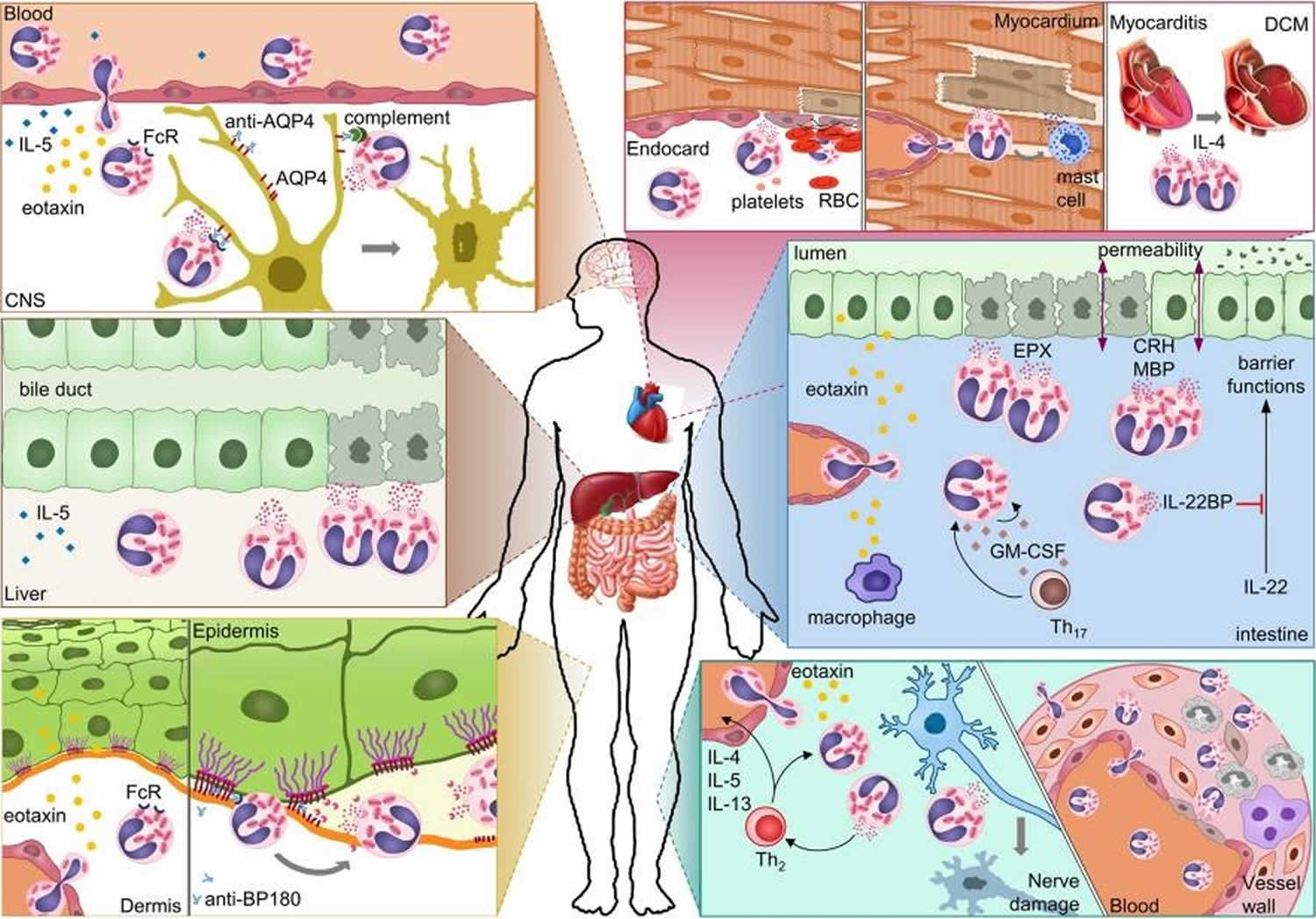 eosinophils-eosinophils-function-causes-of-high-and-low-eosinophils