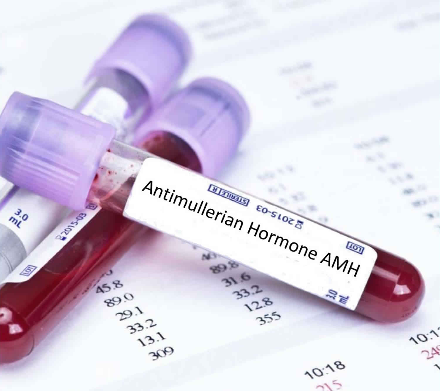 amh hormone blood test