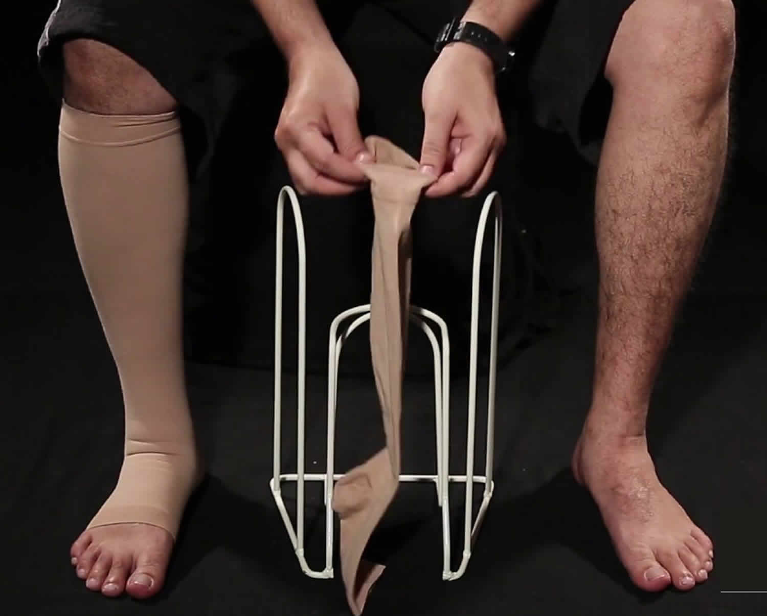 Blood clot causes, symptoms, diagnosis, prevention, prognosis & treatment