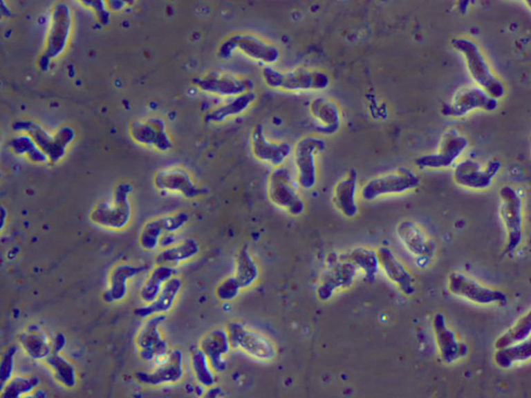 Naegleria fowleri amoeba or brain eating amoeba infection and treatment