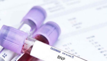 bnp test