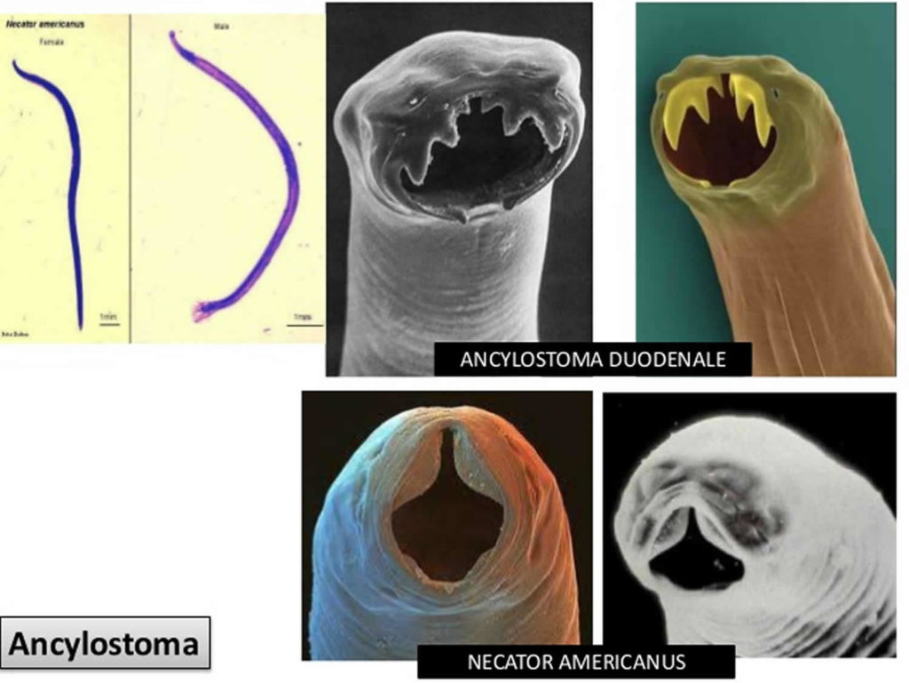 Hookworm Infection, Symptoms, Diagnosis & Hookworm Treatment In Humans