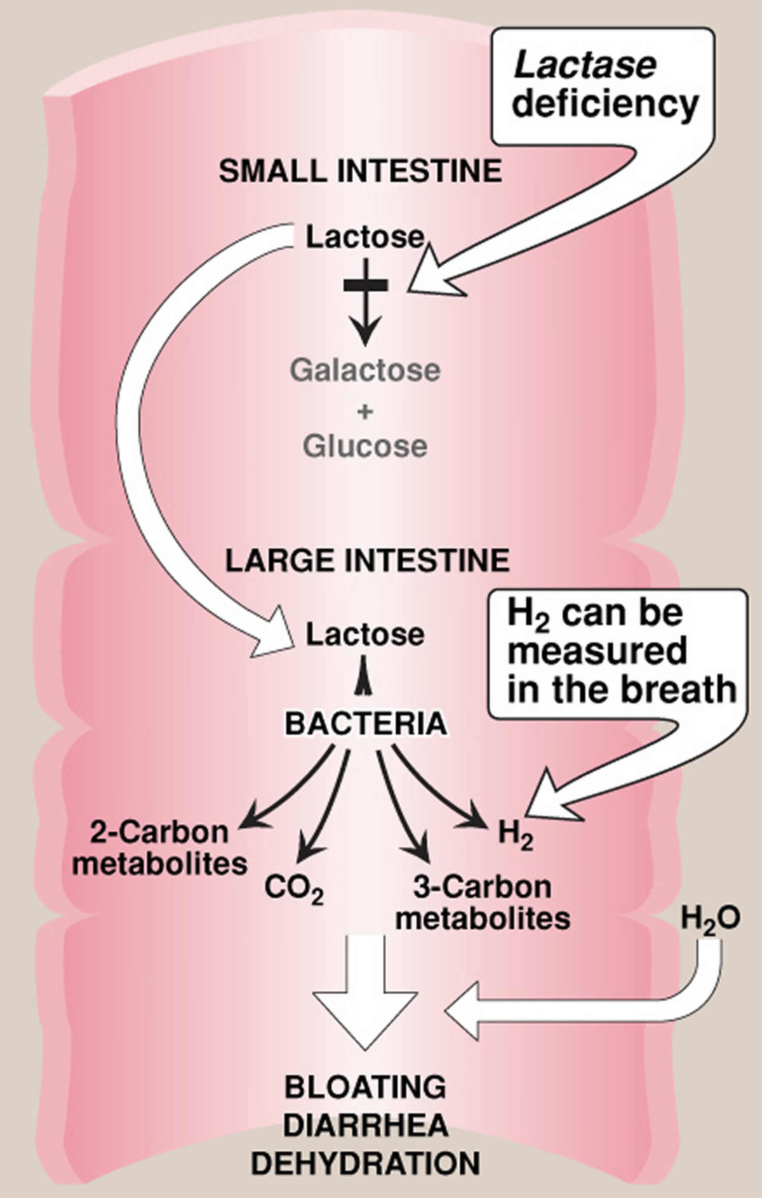 Lactase enzyme function, source, lactase deficiency and treatment