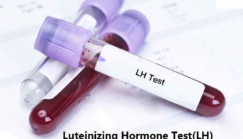 luteinizing hormone