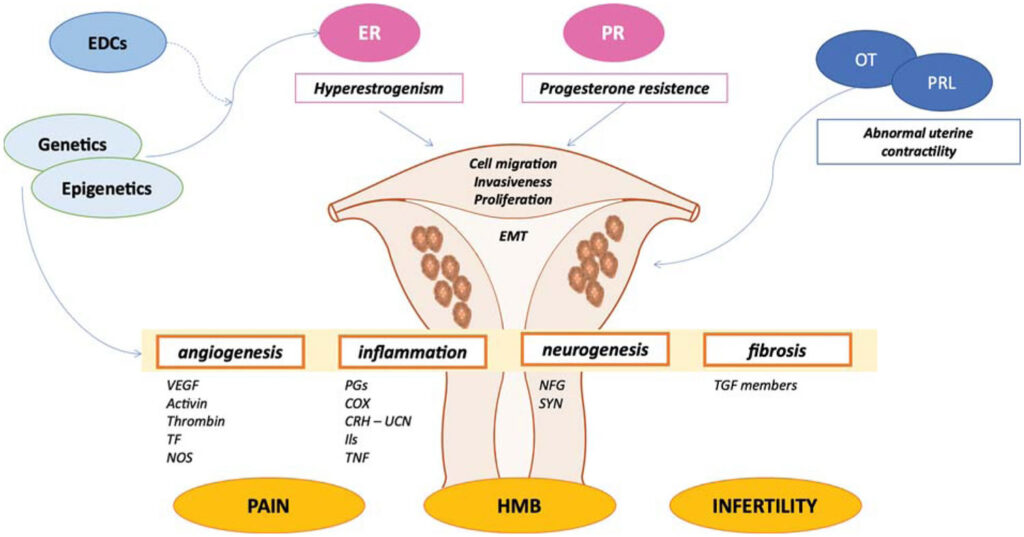 Adenomyosis, adenomyosis & pregnancy, symptoms, diagnosis & treatment