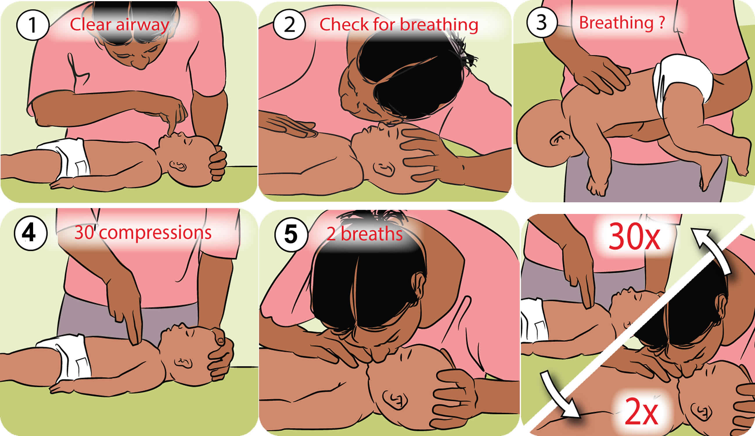 cardiopulmonary resuscitation for babies under 12 months