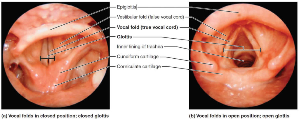 Epiglottis anatomy, location, function and epiglottis infection