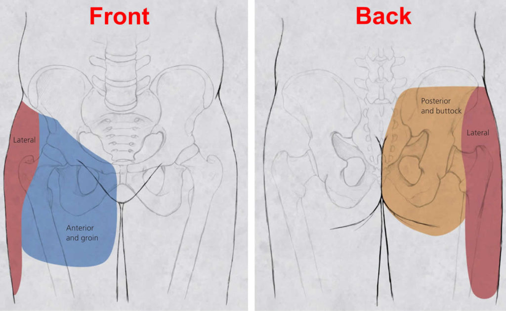 Hip Pain Causes Hip Pain Symptoms Diagnosis And Hip Pain Treatment