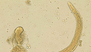 Strongyloides