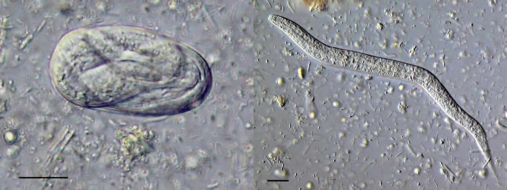 strongyloides-parasite-symptoms-diagnosis-strongyloides-treatment