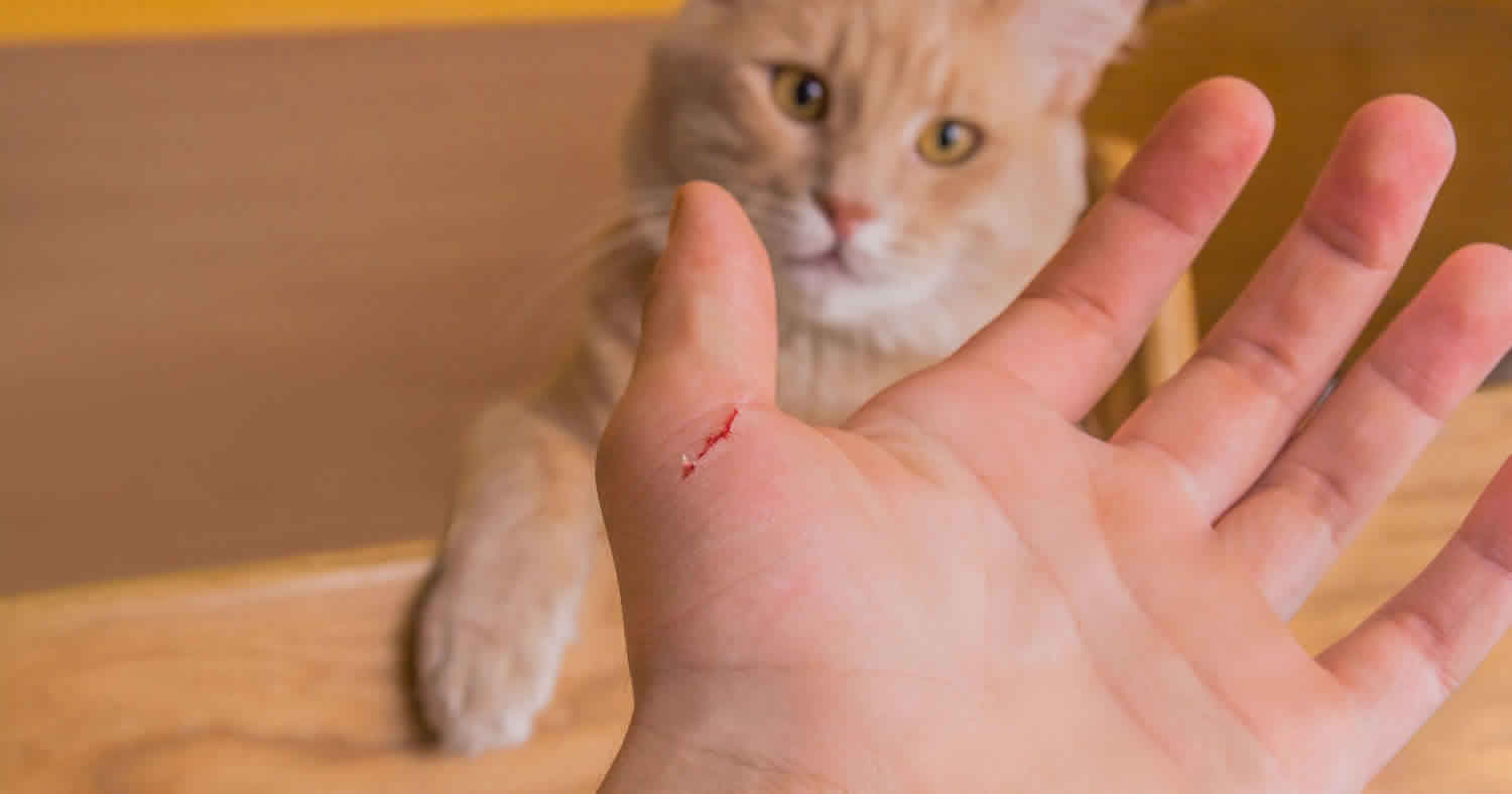 Cat Scratch Disease Cat Scratch Fever Causes Symptoms Diagnosis