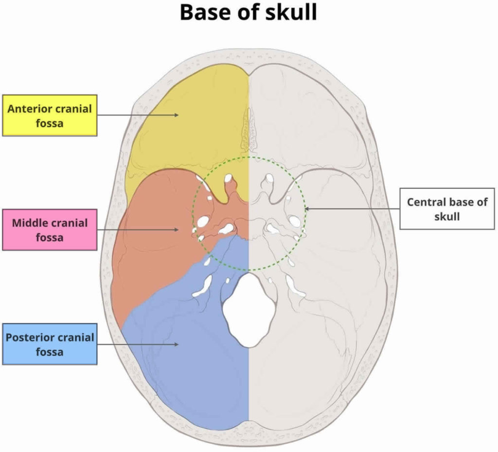 Arachnoid cyst causes, symptoms, diagnosis, prognosis and treatment