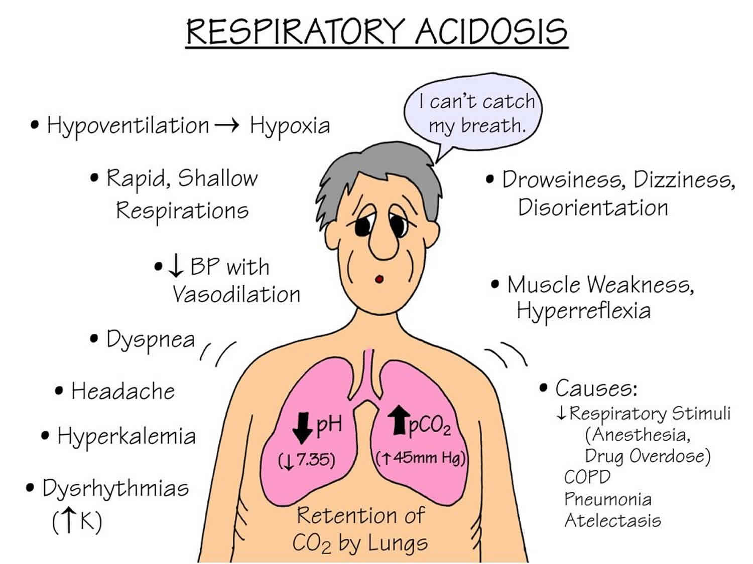 Respiratory Acidosis Causes Symptoms Signs Lab Values And Treatment   Respiratory Acidosis 