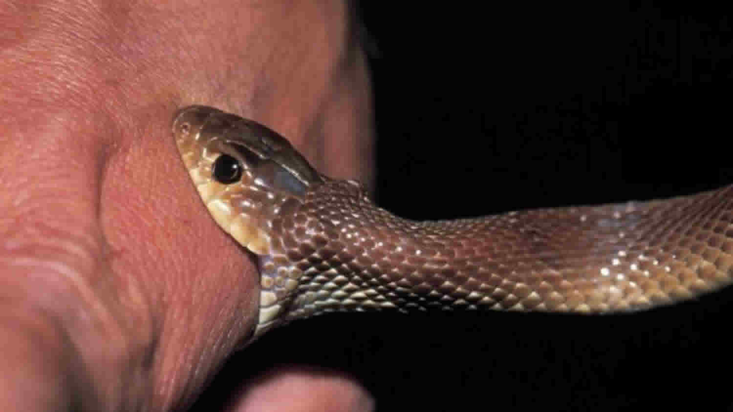 is-it-safe-to-suck-the-venom-out-of-a-snake-bite