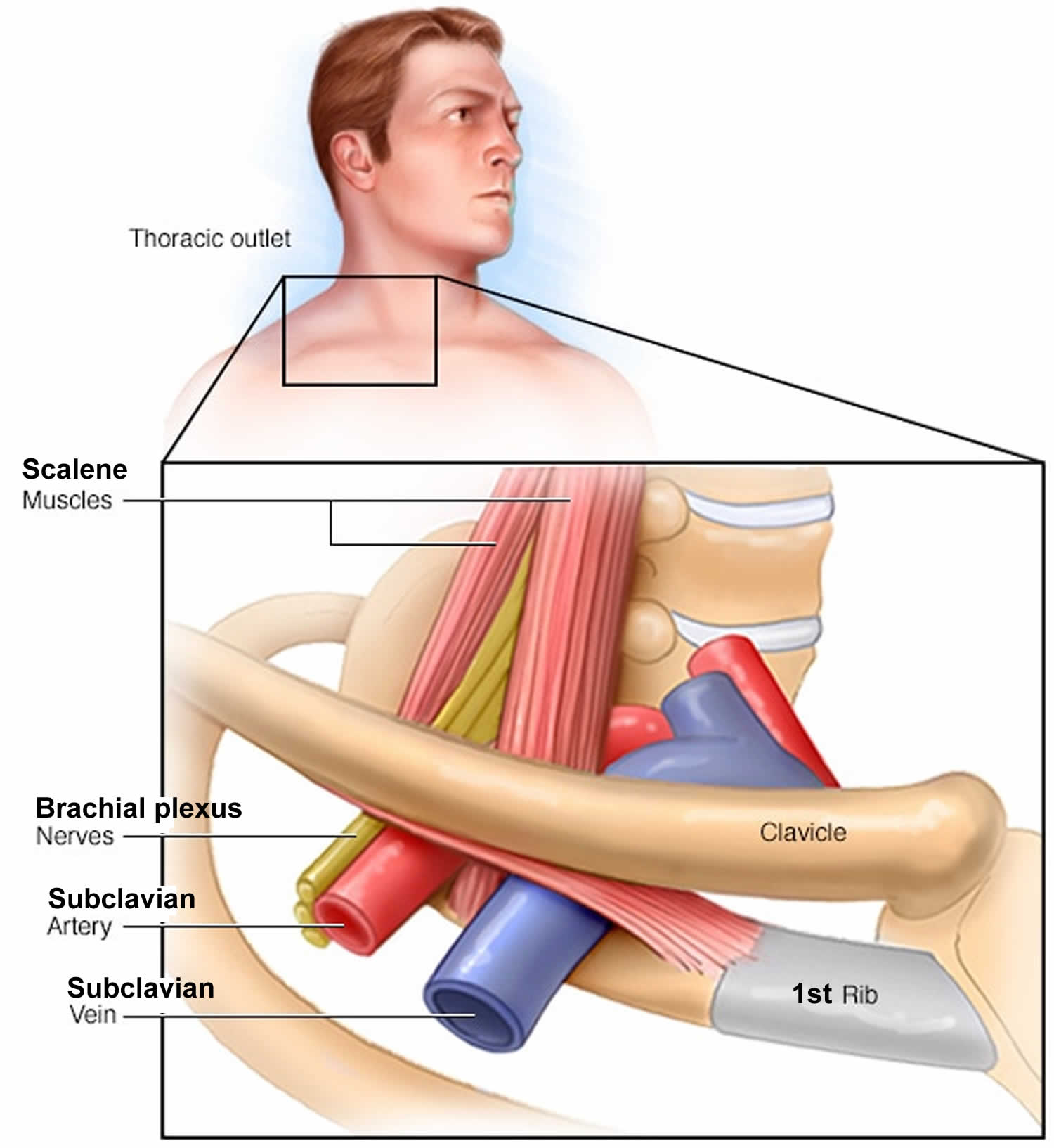 thoracic outlet syndrome treatment
