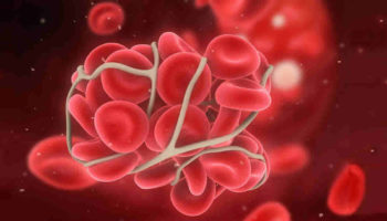 thrombophilia